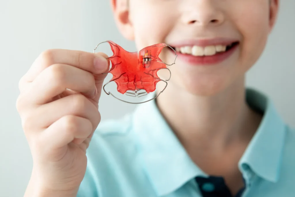 Bambino sorridente con maglietta azzurra mostra un apparecchio ortodontico mobile con placca in resina rossa e archi metallici, utilizzato per l'allineamento dei denti in età pediatrica. Il volto è sfocato e l'attenzione è focalizzata sull'apparecchio tenuto in mano.