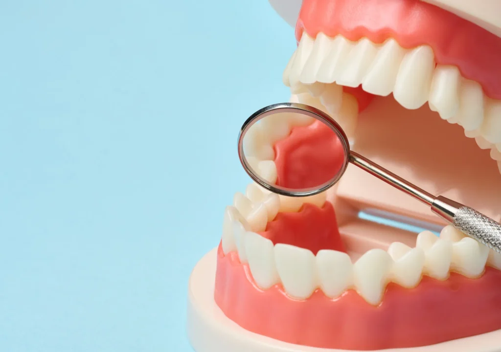 Modello didattico di arcata dentale aperta con denti bianchi e gengive rosa, esaminato con uno specchietto odontoiatrico posizionato all'interno della bocca. Sfondo azzurro chiaro.