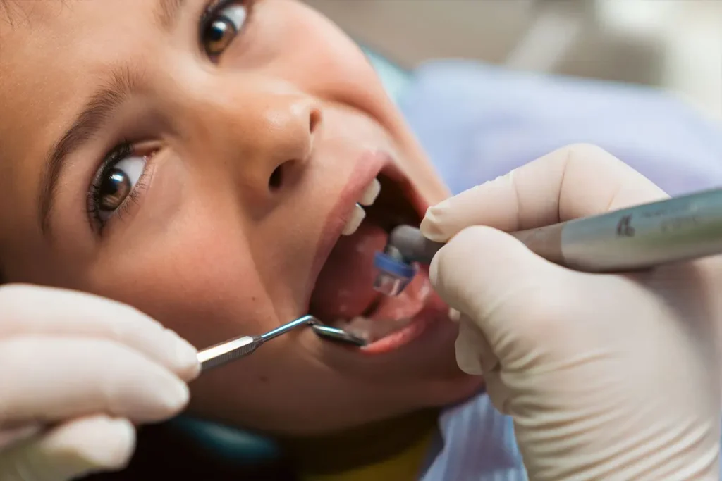Trattamento con ozono terapia su un giovane paziente, senza anestesia e senza contatto diretto con il dente.