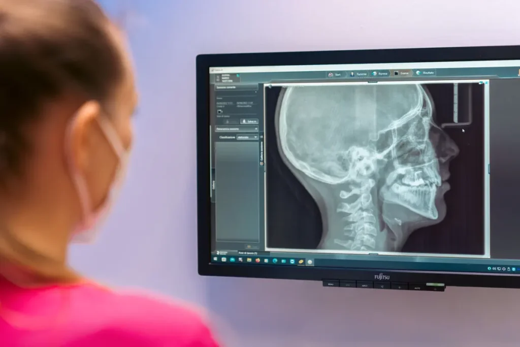 Radiografia digitale del cranio visualizzata sul monitor dello studio durante la refertazione.