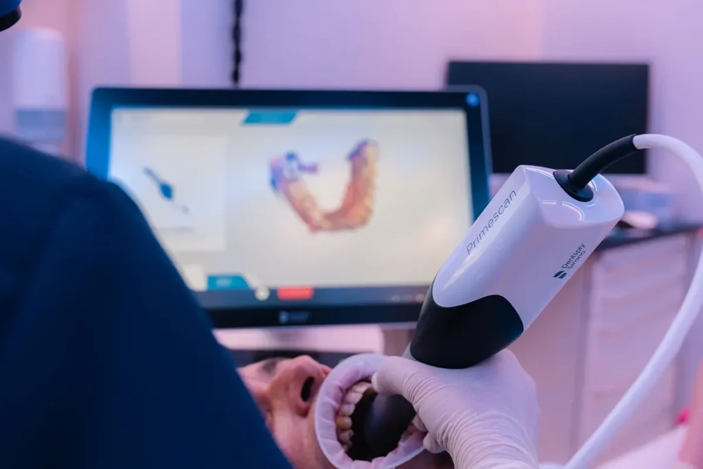 Rilevazione dell'impronta con lo scanner intraorale, con il modello 3D dell'arcata visibile sul monitor.